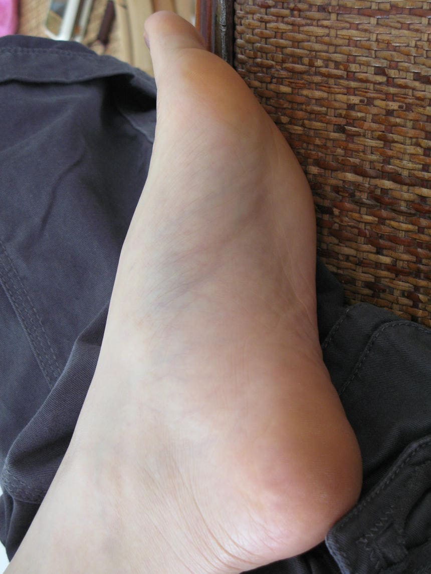 这个是脚底，你看够不够近