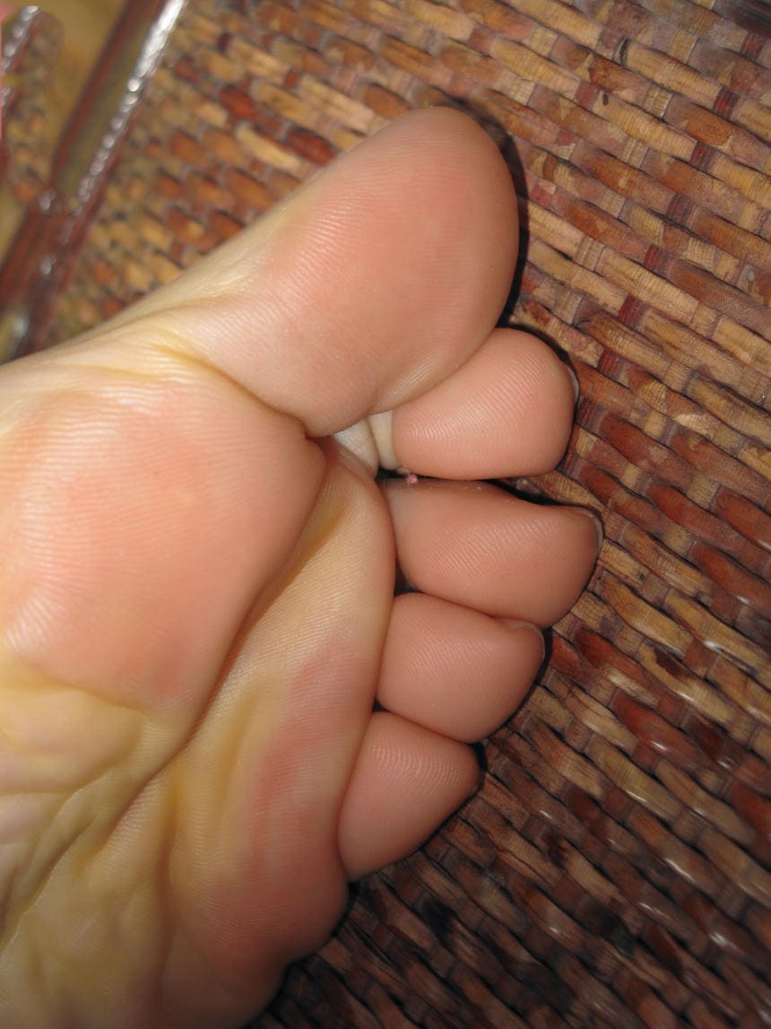 这个是脚底，你看够不够近